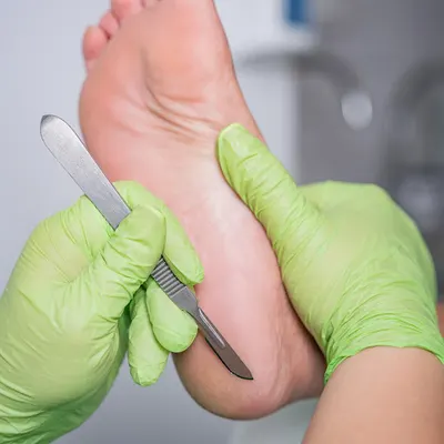 PLANTARIS Podologia, Diagnostyka oraz Wkładki Ortopedyczne Tychy